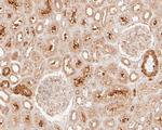 LPP Antibody in Immunohistochemistry (Paraffin) (IHC (P))
