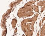 LPP Antibody in Immunohistochemistry (Paraffin) (IHC (P))