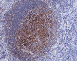 CD35 Recombinant Rabbit Monoclonal Antibody (JE54-31)