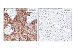 EGFRvIII Recombinant Rabbit Monoclonal Antibody (RM419)