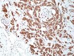 MSI2 Antibody in Immunohistochemistry (Paraffin) (IHC (P))