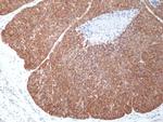 MSI2 Recombinant Rabbit Monoclonal Antibody (RM422)