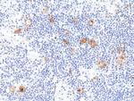 CD30 Recombinant Rabbit Monoclonal Antibody (RM425)