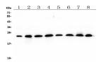 RAB11B Antibody in Western Blot (WB)