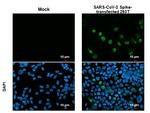 SARS-CoV-2 Spike Protein S1 Antibody in Immunocytochemistry (ICC/IF)