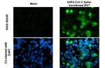 SARS-CoV-2 Spike Protein S1 Antibody in Immunocytochemistry (ICC/IF)