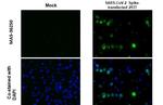 SARS-CoV-2 Spike Protein S1 Recombinant Rabbit Monoclonal Antibody (HL263)