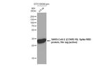 SARS-CoV-2 Spike Protein (RBD) Antibody in Western Blot (WB)