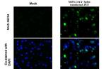 SARS-CoV-2 Spike Protein S2 Recombinant Rabbit Monoclonal Antibody (HL237)