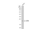 GPX8 Antibody in Western Blot (WB)