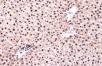Phospho-ATR (Thr1989) Antibody in Immunohistochemistry (Paraffin) (IHC (P))