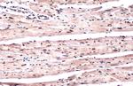 Phospho-ATR (Thr1989) Antibody in Immunohistochemistry (Paraffin) (IHC (P))