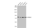 ACSL4 Antibody in Western Blot (WB)