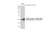 Phospho-ERK1/ERK2 (Thr202, Tyr204, Thr185, Tyr187) Recombinant Rabbit Monoclonal Antibody (HL173)