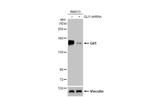 Gli1 Antibody in Western Blot (WB)