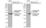 Phospho-p70 S6 Kinase (Thr421, Ser424) Antibody in Western Blot (WB)