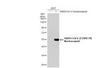 SARS-CoV-2 Nucleocapsid Antibody in Western Blot (WB)