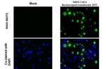 SARS-CoV-2 Nucleocapsid Recombinant Rabbit Monoclonal Antibody (HL453)