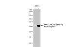 SARS-CoV-2 Nucleocapsid Antibody in Western Blot (WB)