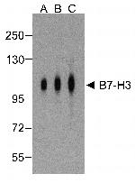 CD276 (B7-H3) Antibody in Western Blot (WB)