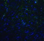TMIGD2 Antibody in Immunohistochemistry (Paraffin) (IHC (P))