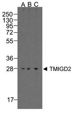 TMIGD2 Antibody in Western Blot (WB)