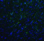 TMIGD2 Antibody in Immunohistochemistry (Paraffin) (IHC (P))