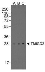 TMIGD2 Antibody in Western Blot (WB)