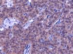 PTH Monoclonal Antibody (BAM87)