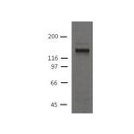 Desmoglein 2 Monoclonal Antibody (10D2)