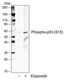 Phospho-p53 (Ser15) Recombinant Rabbit Monoclonal Antibody (P53S15-1C11)