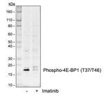 Phospho-4EBP1 (Thr37, Thr46) Antibody in Western Blot (WB)