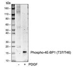 Phospho-4EBP1 (Thr37, Thr46) Antibody in Western Blot (WB)