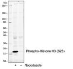 Phospho-Histone H3 (Ser28) Antibody in Western Blot (WB)