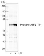 Phospho-ATF2 (Thr71) Recombinant Rabbit Monoclonal Antibody (ATF2T71-G3)