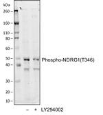 Phospho-NDRG1 (Thr346) Recombinant Rabbit Monoclonal Antibody (NDRG1T346-F5)