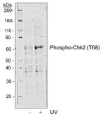 Phospho-Chk2 (Thr68) Recombinant Rabbit Monoclonal Antibody (Chk2T68-D12)