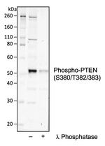 Phospho-PTEN (Ser380, Thr382, Thr383) Recombinant Rabbit Monoclonal Antibody (PTENS380T382383-E4)