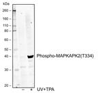 Phospho-MAPKAPK2 (Thr334) Recombinant Rabbit Monoclonal Antibody (MAPKAPK2T334-H2)