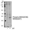 Phospho-MEK3/MEK6 (Ser189, Ser207) Recombinant Rabbit Monoclonal Antibody (MKK3S189MKK6S207-D3)