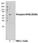 Phospho-NFkB p65 (Ser536) Antibody in Western Blot (WB)