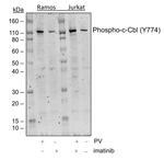 Phospho-c-Cbl (Tyr774) Recombinant Rabbit Monoclonal Antibody (CblY774-R4C5)