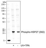 Phospho-HSP27 (Ser82) Recombinant Rabbit Monoclonal Antibody (HSP27S82-CB2)