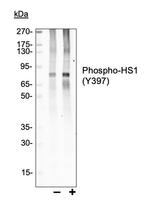 Phospho-HCLS1 (Tyr397) Recombinant Rabbit Monoclonal Antibody (HS1Y397-F12)