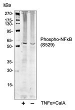 Phospho-NFkB p65 (Ser529) Antibody in Western Blot (WB)