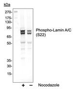 Phospho-Lamin A/C (Ser22) Recombinant Rabbit Monoclonal Antibody (LaminACS22-CF12)