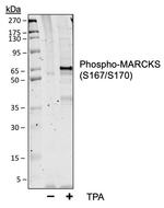Phospho-MARCKS (Ser167, Ser170) Recombinant Rabbit Monoclonal Antibody (MARCKSS167170-C9)
