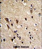 TUBB1 Antibody in Immunohistochemistry (Paraffin) (IHC (P))