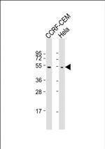 TUBB1 Antibody in Western Blot (WB)