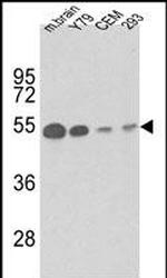 TUBB1 Antibody in Western Blot (WB)